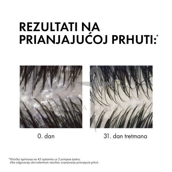  DERCOS Šampon protiv prhuti za normalnu ili masnu kosu, 390ml 