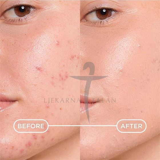 Bioderma Sebium Kerato+ COVER gel-krema